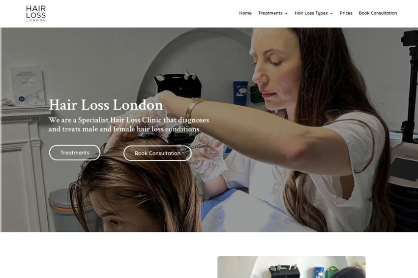 Hair Loss Clinic website design for Hair Loss London